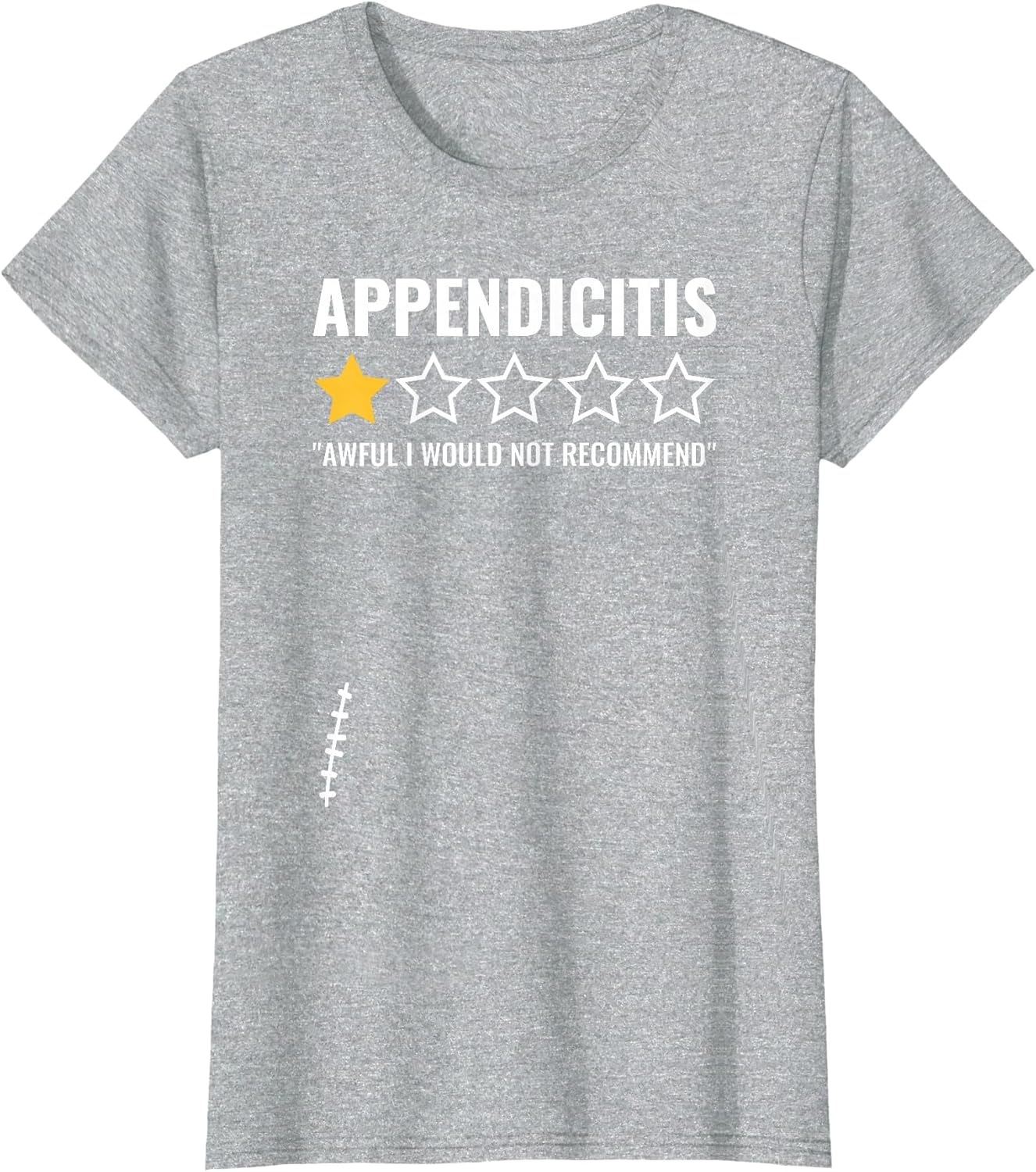 Appendicitis Awful Would Not Recommend Appendectomy Appendix