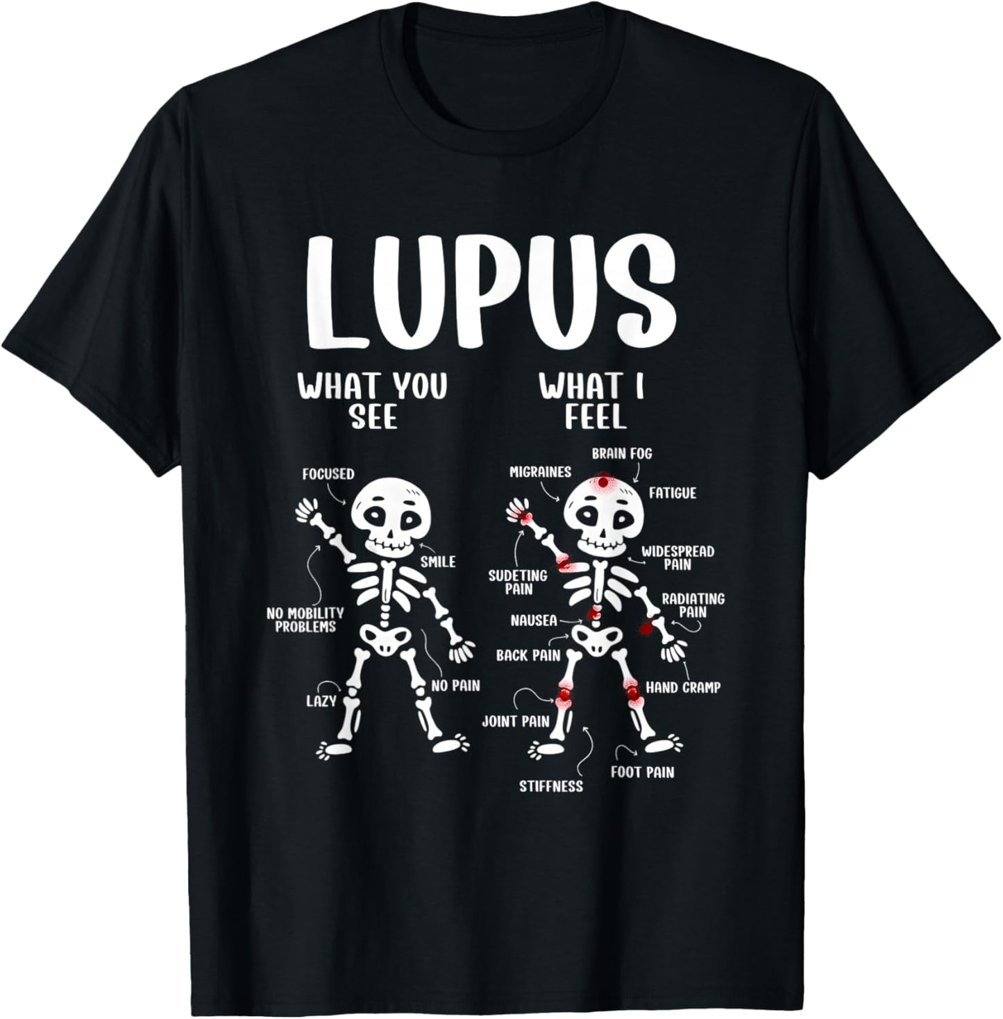 Skeleton Lupus What You See What I Feel T-Shirt - T-Shirt | Black